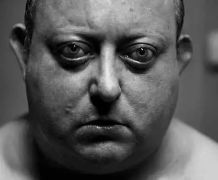 Laurence R. Harvey in The Human Centipede 2 (Full Sequence)