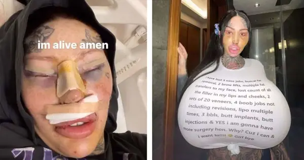 Mary Magdalene: Surgery Addict, 26, krijgt 'Barbie Nose' en 'Cat Eyes' om eruit te zien als een boself